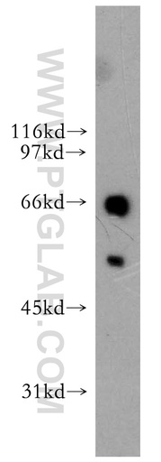 [13182-1-AP-150UL] ETV6 Polyclonal antibody