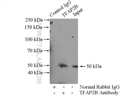 [13183-1-AP-150UL] TFAP2B Polyclonal antibody