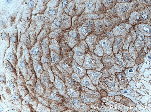 [13184-1-AP-20UL] CDSN Polyclonal antibody