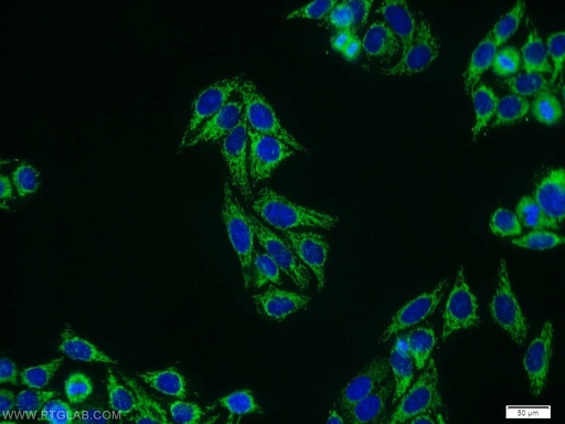 [13186-1-AP-150UL] MLF1IP Polyclonal antibody