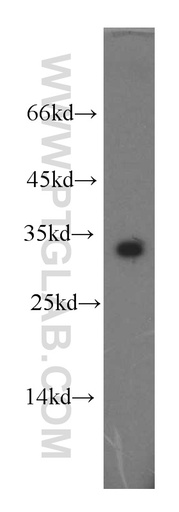 [13188-1-AP-20UL] CLEC2D Polyclonal antibody