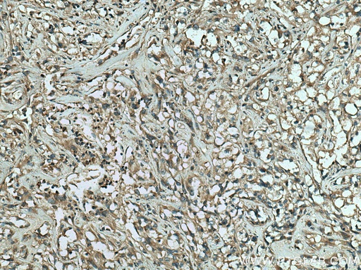 [13189-1-AP-150UL] RAB25 Polyclonal antibody