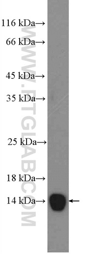 [13192-1-AP-150UL] SAA Polyclonal antibody