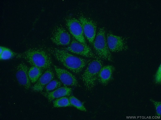 [13193-1-AP-20UL] PPM1B Polyclonal antibody