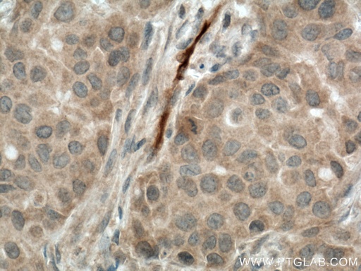 [13198-2-AP-150UL] CA1 Polyclonal antibody