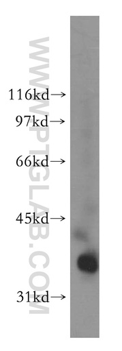 [13199-2-AP-150UL] PDLIM3 Polyclonal antibody