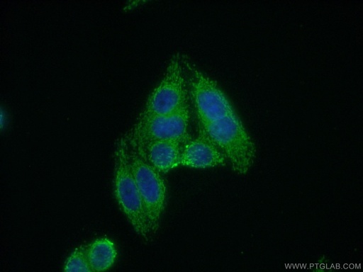 [13203-1-AP-20UL] DCLRE1B Polyclonal antibody