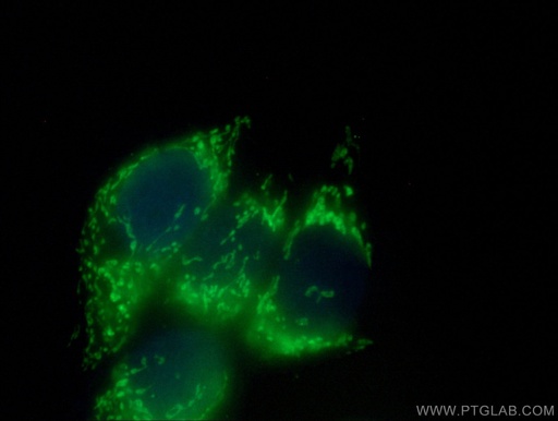 [13206-1-AP-150UL] AK3L1 Polyclonal antibody