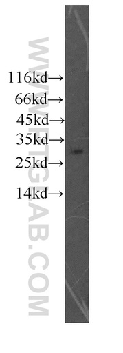 [13208-1-AP-20UL] Granzyme M Polyclonal antibody