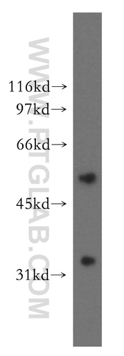 [13209-1-AP-150UL] AKR7A3 Polyclonal antibody