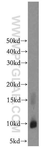 [13212-1-AP-20UL] CARTPT Polyclonal antibody