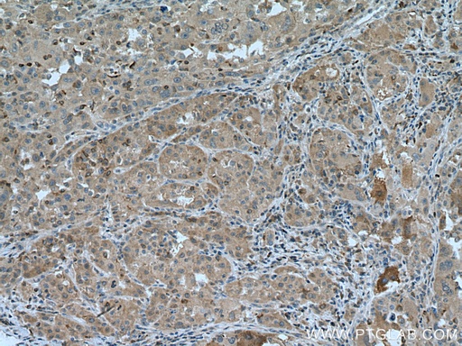 [13213-1-AP-150UL] ARH Polyclonal antibody