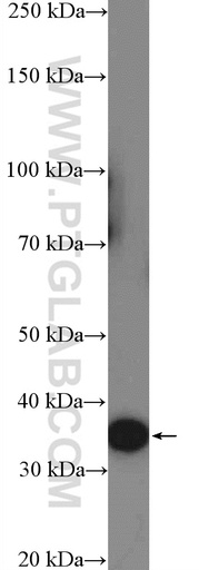 [13215-1-AP-150UL] RFPL1/2/3 Polyclonal antibody