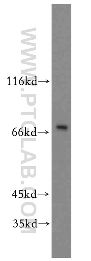 [13216-1-AP-150UL] SOX5 Polyclonal antibody