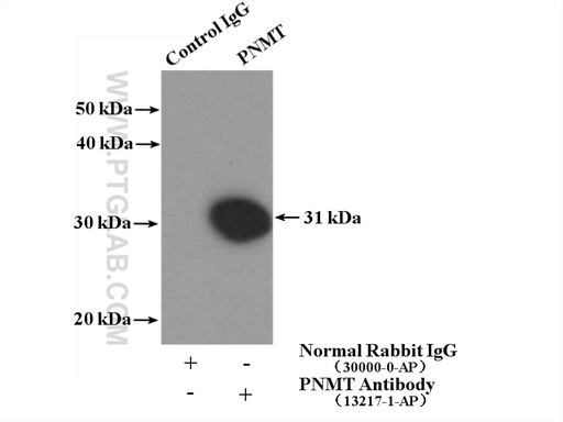 [13217-1-AP-150UL] PNMT Polyclonal antibody