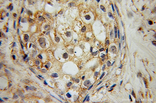 [13223-2-AP-20UL] RAMP2 Polyclonal antibody