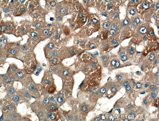 [13224-1-AP-20UL] LRG1 Polyclonal antibody