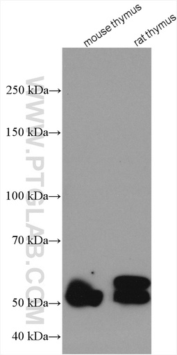[13225-1-AP-150UL] RCBTB2 Polyclonal antibody