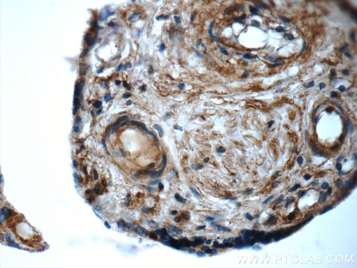 [13227-1-AP-150UL] ARSB Polyclonal antibody