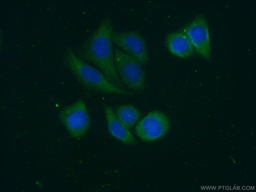 [13228-1-AP-150UL] Alpha 2-Antiplasmin Polyclonal antibody