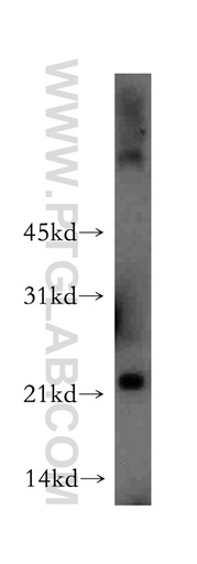 [13229-1-AP-150UL] MYL4 Polyclonal antibody