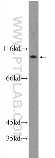 [13231-1-AP-20UL] ATP12A Polyclonal antibody