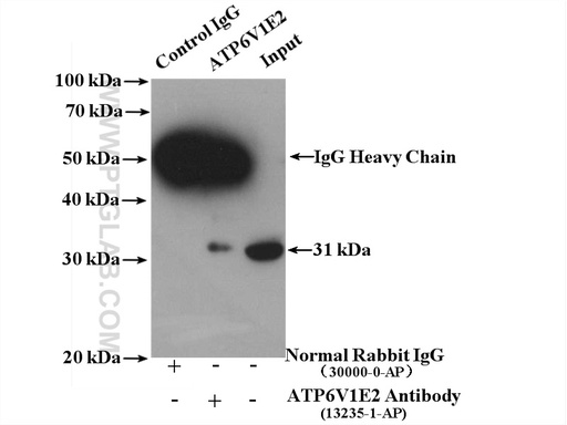 [13235-1-AP-150UL] ATP6V1E2 Polyclonal antibody