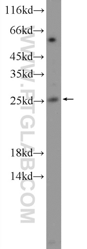 [13236-1-AP-150UL] NMNAT3 Polyclonal antibody
