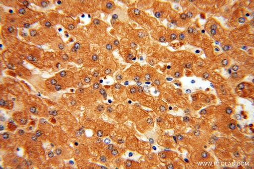 [13237-1-AP-20UL] DPYS Polyclonal antibody