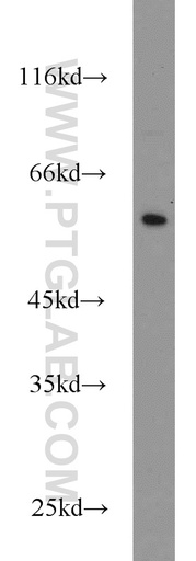 [13243-1-AP-150UL] CYP4F12 Polyclonal antibody