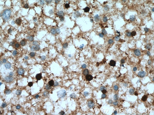[13244-1-AP-150UL] ASPA Polyclonal antibody