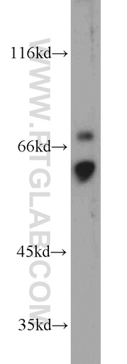 [13245-1-AP-150UL] CD89 Polyclonal antibody