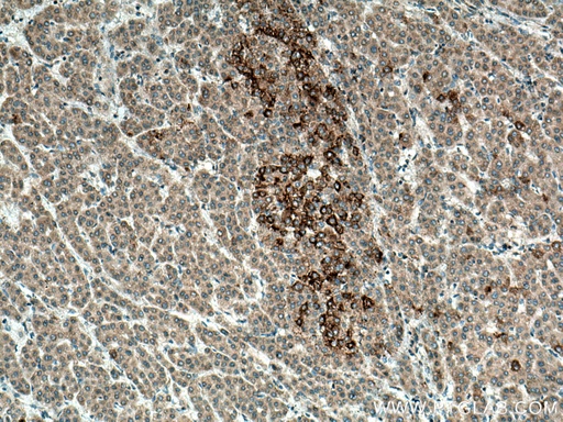 [13252-1-AP-20UL] SRGAP1 Polyclonal antibody