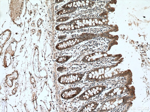 [13253-1-AP-150UL] BMP5 Polyclonal antibody