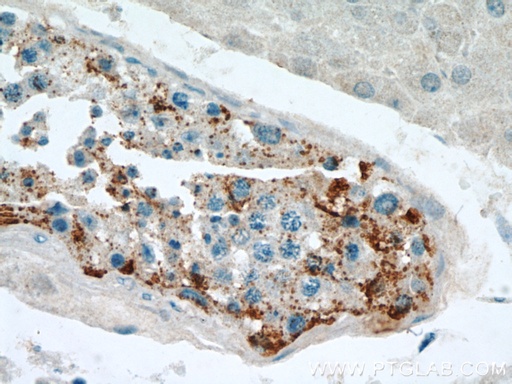 [13255-1-AP-150UL] SPPL2A Polyclonal antibody