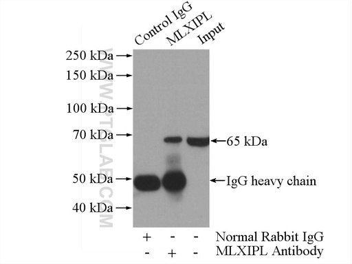 [13256-1-AP-20UL] MLXIPL Polyclonal antibody