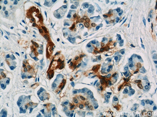 [13258-1-AP-20UL] Gamma Adaptin Polyclonal antibody