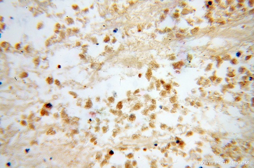 [13261-3-AP-20UL] DLX3 Polyclonal antibody