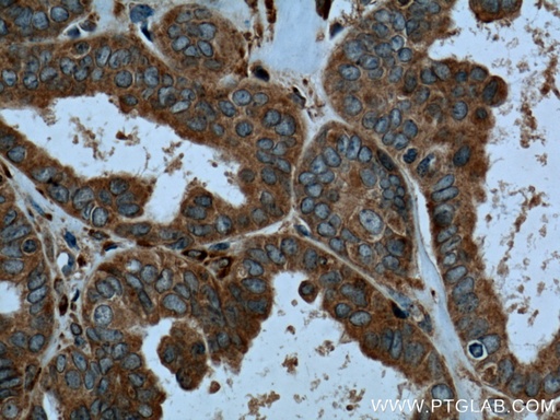 [13263-1-AP-150UL] CaMKIV Polyclonal antibody