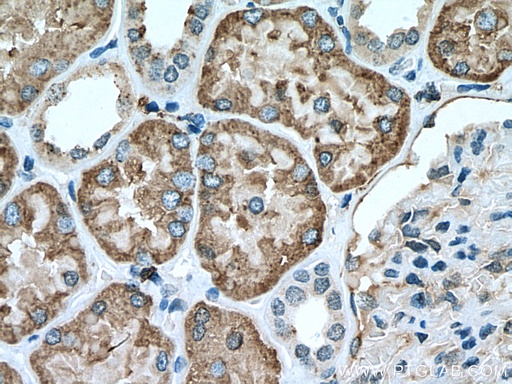 [13264-1-AP-20UL] GGH Polyclonal antibody