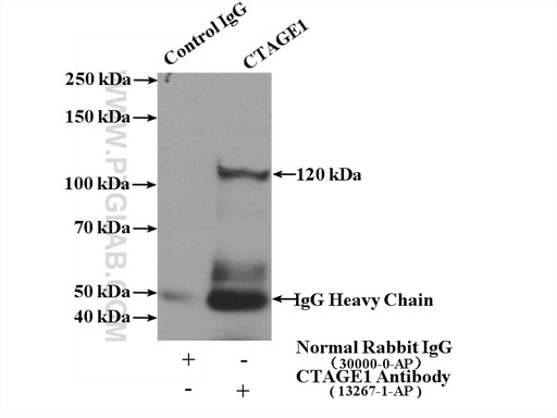 [13267-1-AP-150UL] CTAGE1 Polyclonal antibody