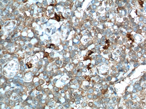 [13268-1-AP-150UL] IDO1 Polyclonal antibody