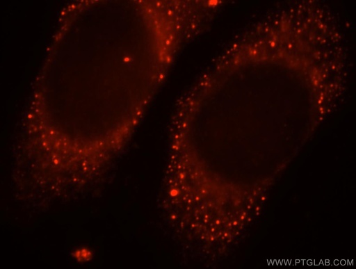 [13270-1-AP-150UL] MPPED2 Polyclonal antibody