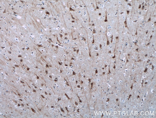 [13271-1-AP-20UL] NGEF Polyclonal antibody