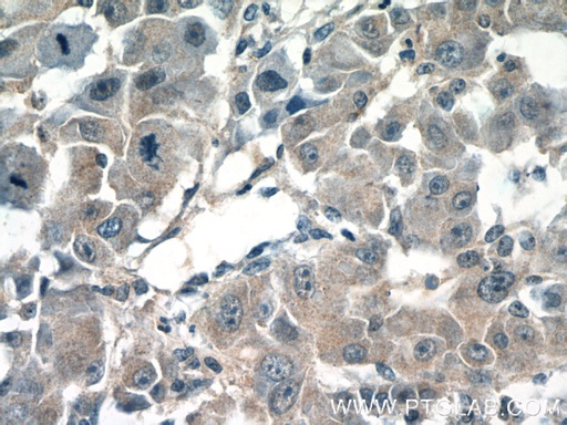 [13274-1-AP-20UL] CPEB1 Polyclonal antibody