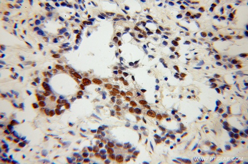 [13275-1-AP-20UL] NXF3 Polyclonal antibody
