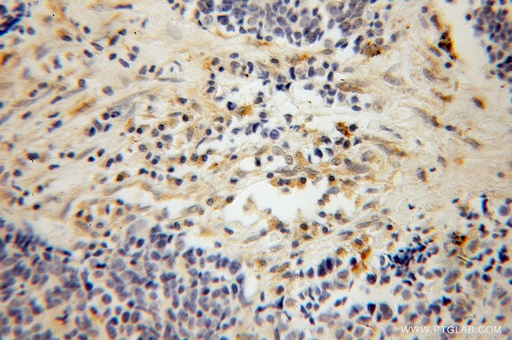 [13284-1-AP-20UL] PARVG Polyclonal antibody