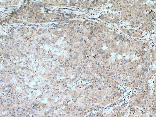 [13285-1-AP-20UL] ZBP1 Polyclonal antibody