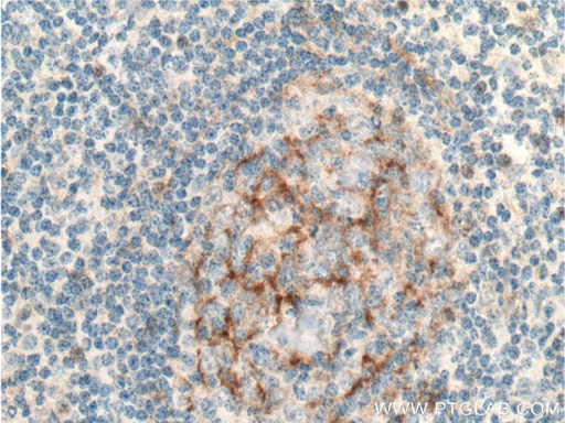 [13287-1-AP-150UL] IL-12RB1 Polyclonal antibody