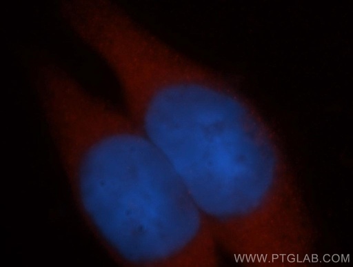 [13288-2-AP-20UL] ADH6 Polyclonal antibody